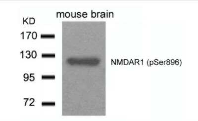 Western Blot: NMDAR1 [p Ser896] Antibody [NB100-82092]